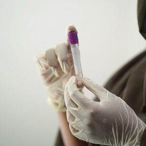 Kits. Are they Safe? MBMC