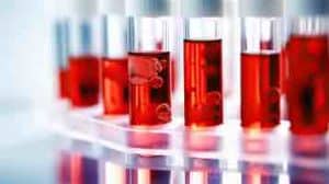 C-reactive Protein, STI, Herpes, CRP blood Tests MBMC
