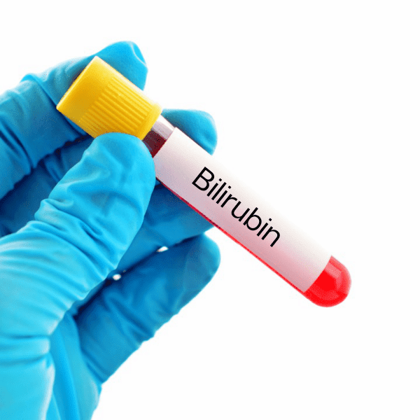 A-bilirubin test at home - Product ID: 15651004