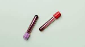 PCR test kit, erectile dysfunction symptoms HPV Herpes exam MBMC
