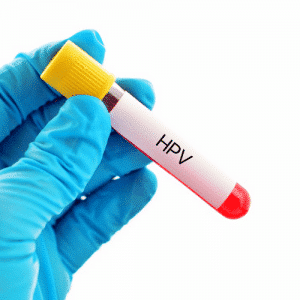 HPV Variant type test Men & women testing