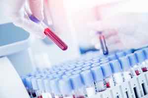 Immuno Blood Levels: What is It about?