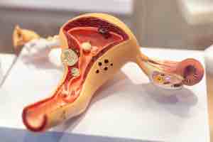 What are the Causes of Diseases of the Cervix?