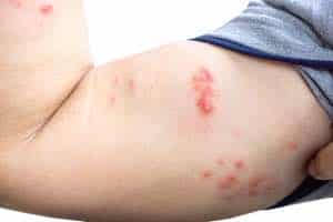 Guidelines And Who Should Get Checked?