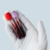 Organ removal would shock your life?