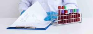 Ca125, ovarian blood cancer test, HPV MBMC