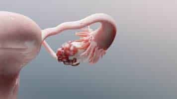 The doctor delivered the baby with a Viral Load?