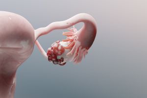 The tumours have shrunk so, is everything gone?