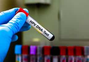 Drugs for viral infections that cure 100% of cases?